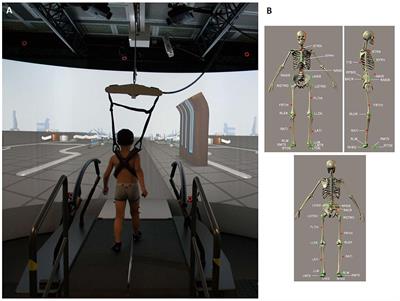 Gait Pattern and Motor Performance During Discrete Gait Perturbation in Children With Autism Spectrum Disorders